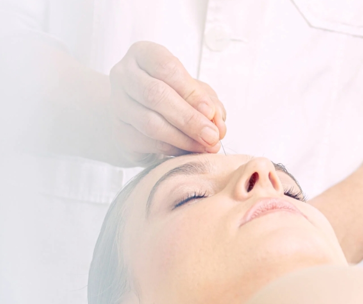 Agopuntura e dieta a basso contenuto di carboidrati: una nuova strategia contro l’obesità